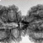17 MK Gaurishankar 40.9mm 7.16gm - Inverse xray