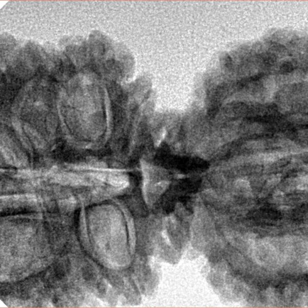 17 MK Gaurishankar 40.9mm 7.16gm - Inverse xray