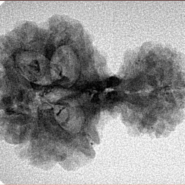 8 MK Garbhgauri & Ganesh 29.1mm 2.78gm - Inverse xray