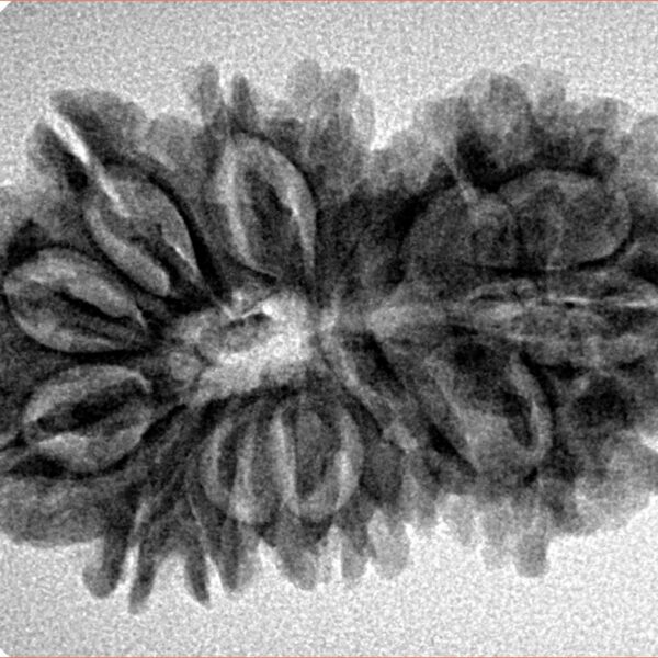 17 MK Gaurishankar 31.9mm 4.62gm - Inverse xray