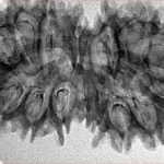 16 MK Gaurishankar 37.9mm 4.94gm - Inverse xray