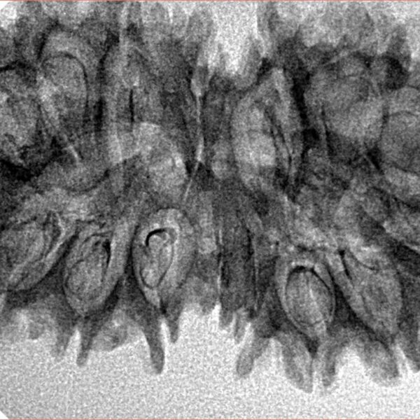 16 MK Gaurishankar 37.9mm 4.94gm - Inverse xray