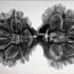 10 Mk Gaurishankar 36mm 6.38gm - Inverse xray