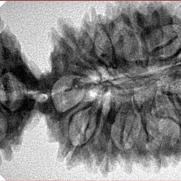 20 MK Gaurishankar 45.7mm 7.4gm - Inverse xray