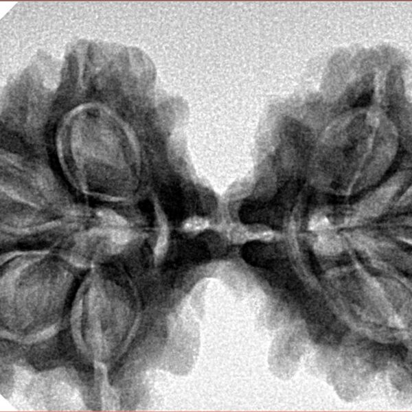 7 MK Gaurishankar 38.6mm 6.86gm - Inverse xray
