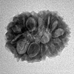 14 Mukhi Rudraksha 19.7mm 2gm - Inverse xray