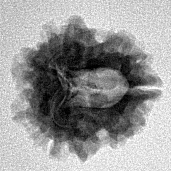 1 Mukhi Rudraksha 19.9mm 2.17gm - Inverse xray