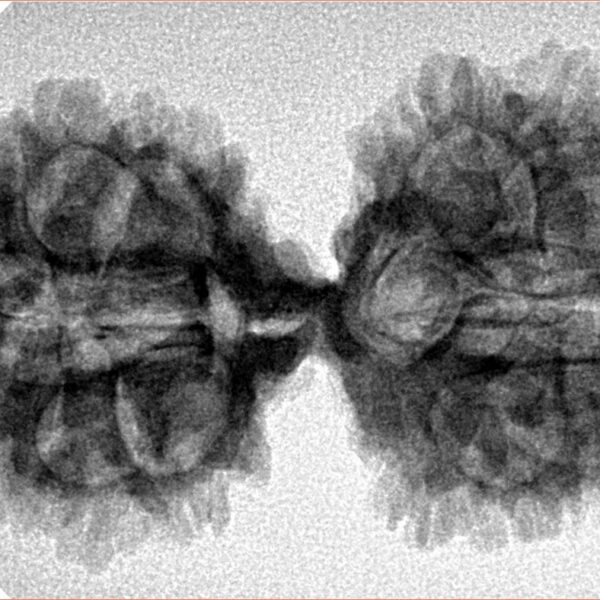 18 MK Gaurishankar 39.6mm 5.71gm - Inverse xray