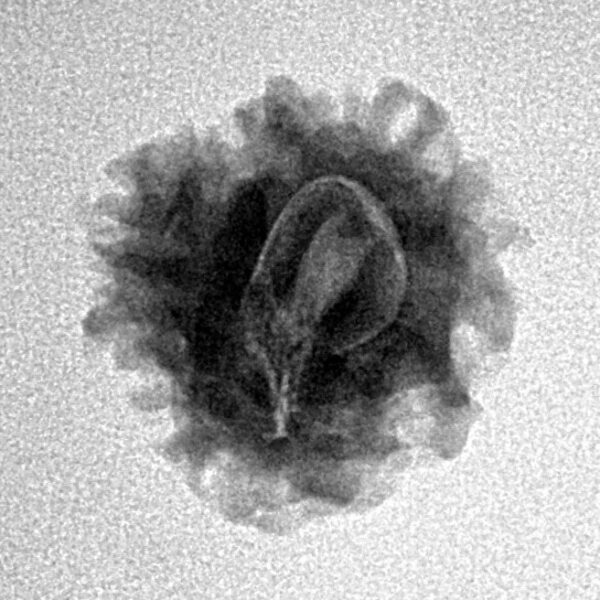 1 Mukhi Rudraksha 18.5mm 1.81gm - Inverse xray