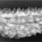 1 Mukhi Rudraksha 50.5mm 6.34gm - Xray