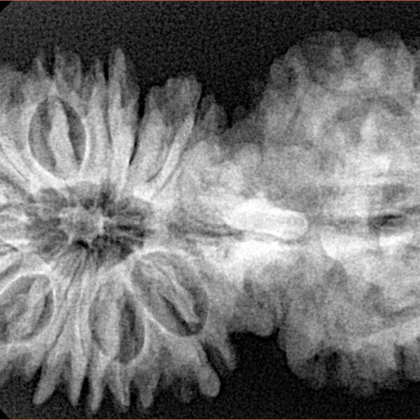 17 MK Gaurishankar 41.7mm 7.66gm - Xray