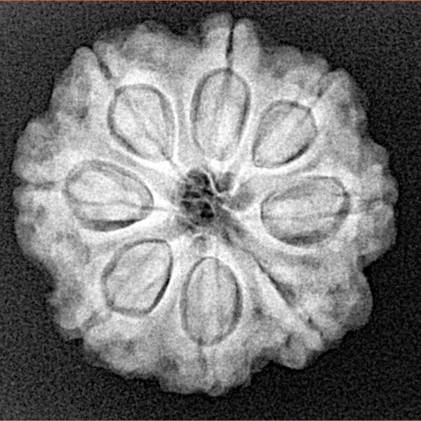 8 Mukhi Rudraksha 23.3mm 4.65gm - Xray