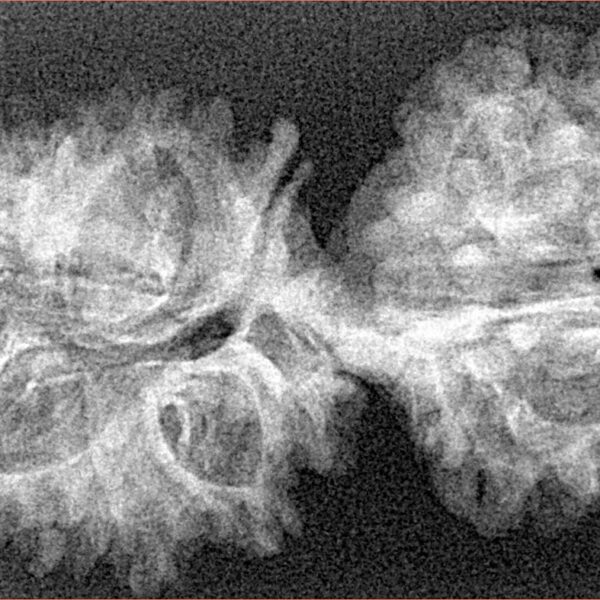 20 MK Gaurishankar 38mm 4gm - Xray