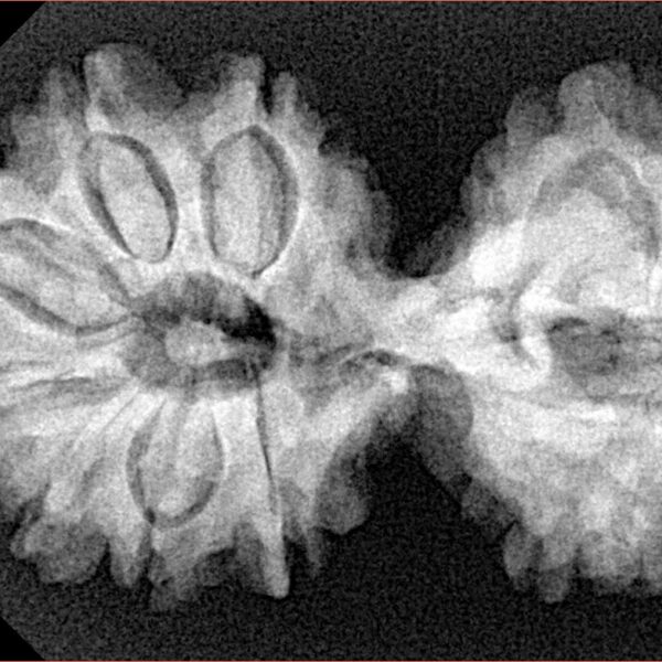 14 Mk Gaurishankar 35.6mm 6.21gm - Xray