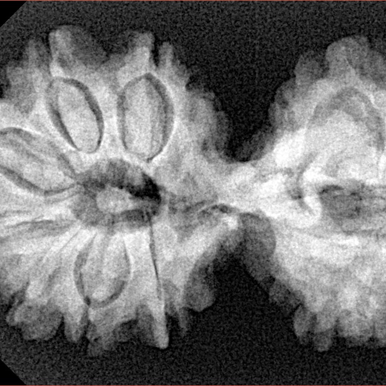 14 Mk Gaurishankar 35.6mm 6.21gm - Xray