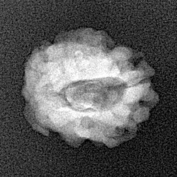 1 Mukhi Rudraksha 17.7mm 1.57gm - Xray
