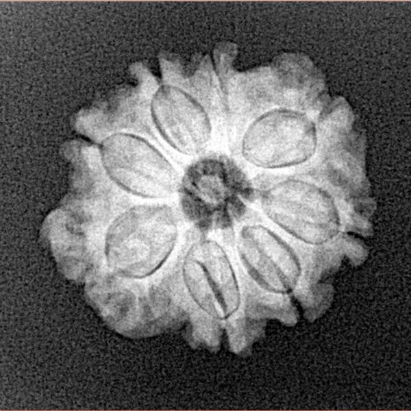 8 Mukhi Rudraksha 20.7mm 2.7gm - Xray