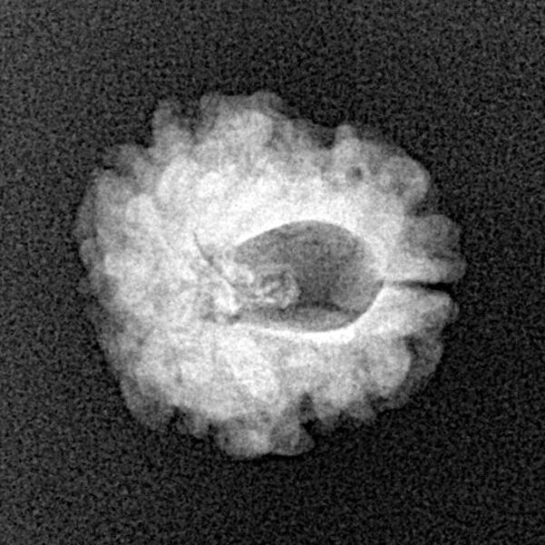 1 Mukhi Rudraksha 17.4mm 1.76gm - Xray