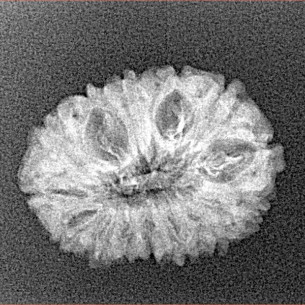 14 Mukhi Rudraksha 22.3mm 1.69gm - Xray