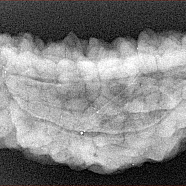 1 Mukhi Rudraksha 38.6mm 6.42gm - Xray