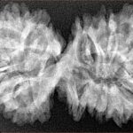 18 MK Gaurishankar 39.6mm 6.33gm - Xray