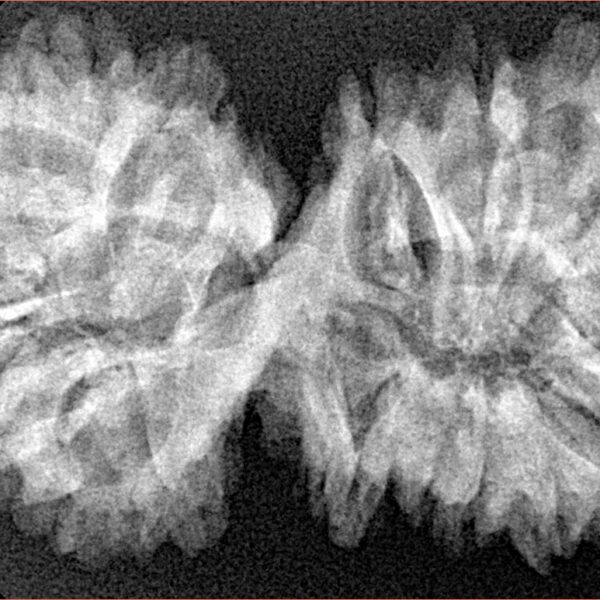 18 MK Gaurishankar 39.6mm 6.33gm - Xray