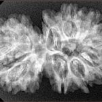 15 MK Gaurishankar 34.3mm 4.92gm - Xray