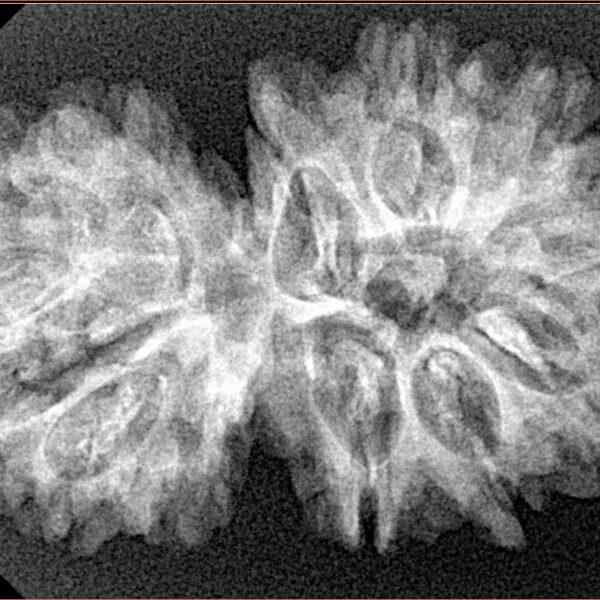 15 MK Gaurishankar 34.3mm 4.92gm - Xray