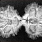 10 Mk Gaurishankar 36mm 6.38gm - Xray
