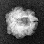 1 Mukhi Rudraksha 17.7mm 2.08gm - Xray