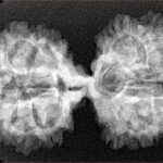 18 MK Gaurishankar 39.6mm 5.71gm - Xray