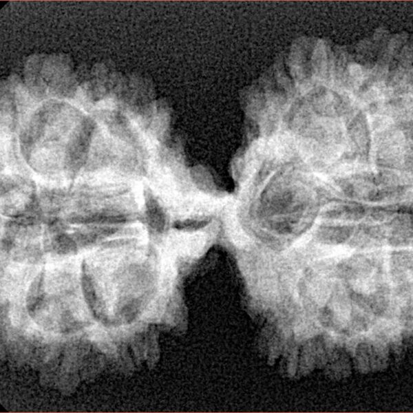 18 MK Gaurishankar 39.6mm 5.71gm - Xray