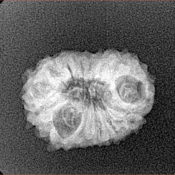 14 Mukhi Rudraksha 20mm 1.94gm - Xray
