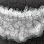 1 Mukhi Rudraksha 39.7mm 5.51gm - Xray