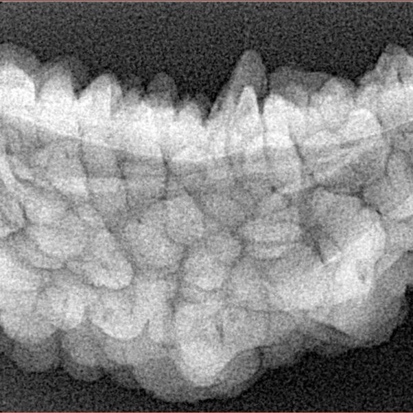 1 Mukhi Rudraksha 39.7mm 5.51gm - Xray
