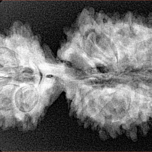 18 MK Gaurishankar 38.5mm 5.49gm - Xray