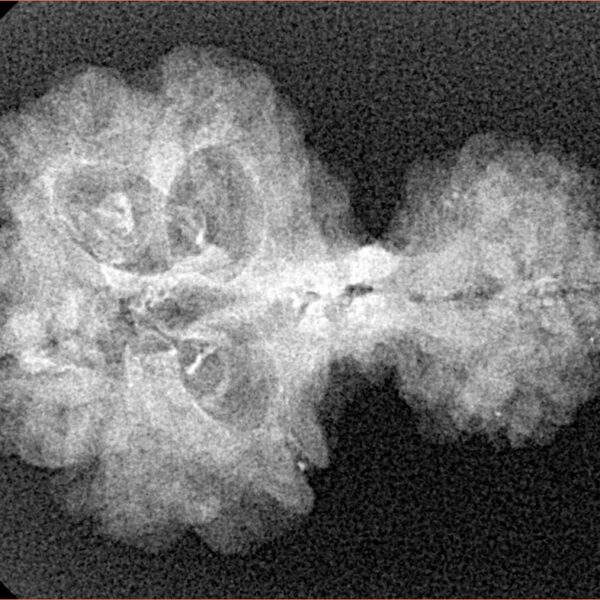 8 MK Garbhgauri & Ganesh 29.1mm 2.78gm - Xray
