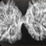 11 MK Gaurishankar 39.3mm 5.52gm - Xray