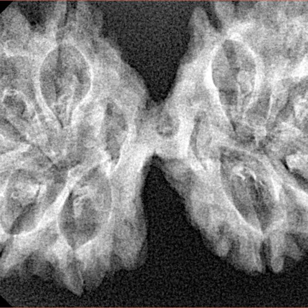11 MK Gaurishankar 39.3mm 5.52gm - Xray