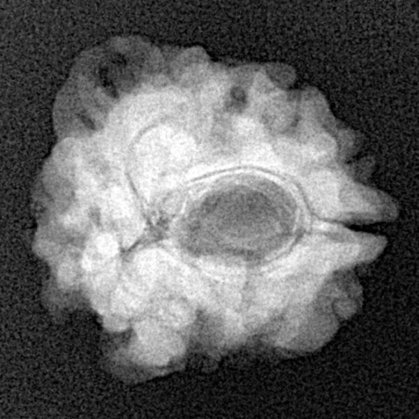 1 Mukhi Rudraksha 21.6mm 2.8gm - Xray