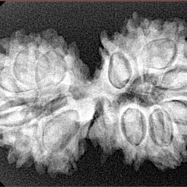 15 MK Gaurishankar 34.8mm 5.63gm - Xray