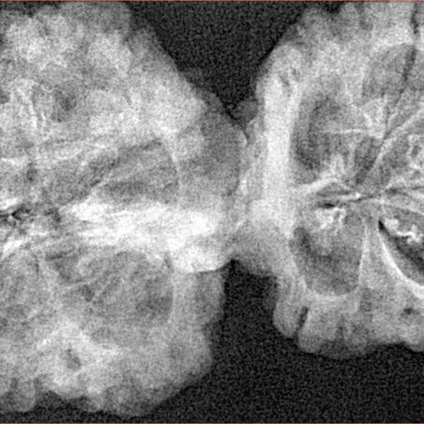 11 Mukhi Mini Trijuti 40mm 6.56gm - Xray
