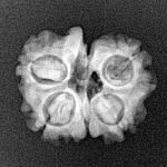 4 Mukhi G.S & Ganesh 19.5mm 2.08gm - Xray