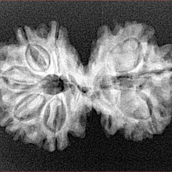 8 MK Gaurishankar 29mm 3.72gm - Xray