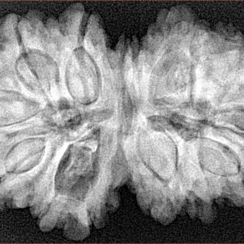14 Mk Gaurishankar 36.1mm 7.73gm - Xray