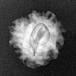 1 Mukhi Rudraksha 18.5mm 1.81gm - Xray
