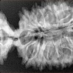 20 MK Gaurishankar 45.7mm 7.4gm - Xray