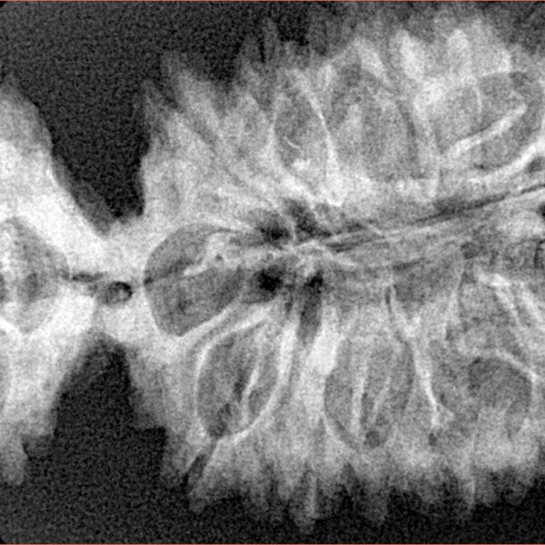 20 MK Gaurishankar 45.7mm 7.4gm - Xray