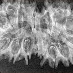 16 MK Gaurishankar 37.9mm 4.94gm - Xray