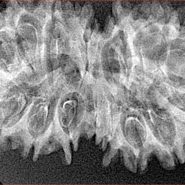 16 MK Gaurishankar 37.9mm 4.94gm - Xray